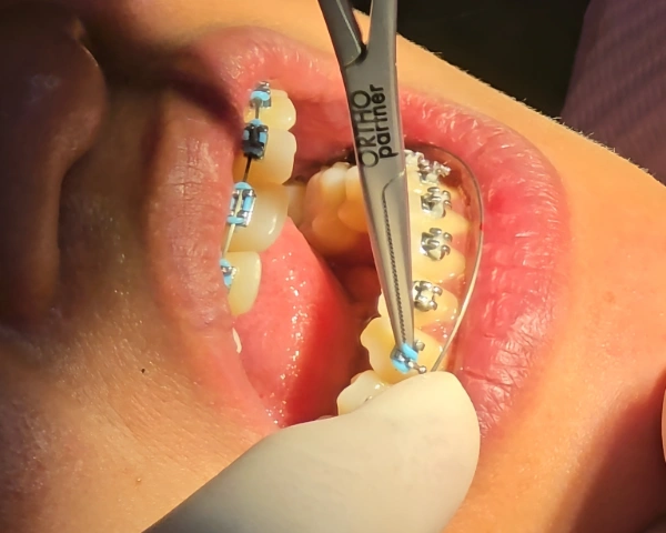 beduya dental orthodontics