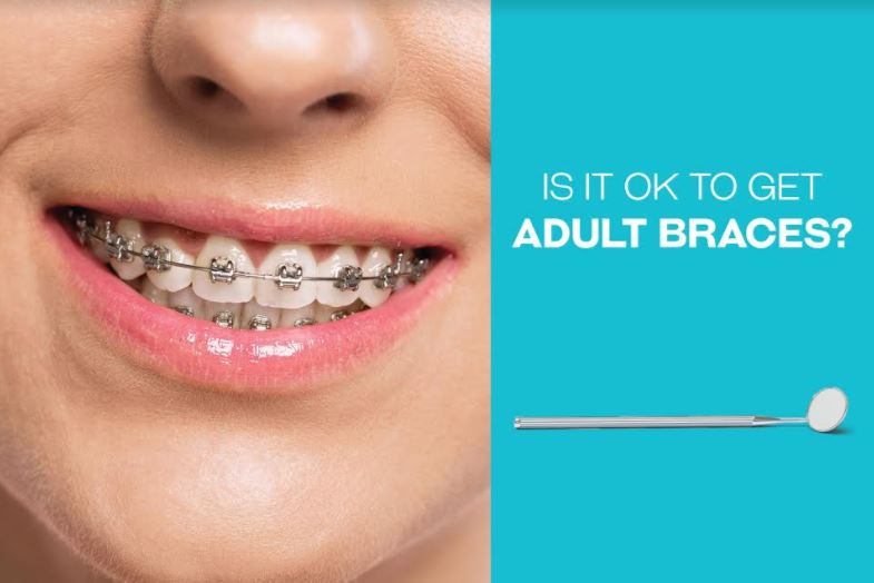 adult braces