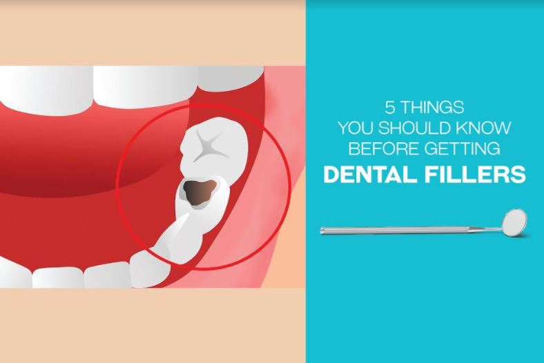 beduya dental fillers